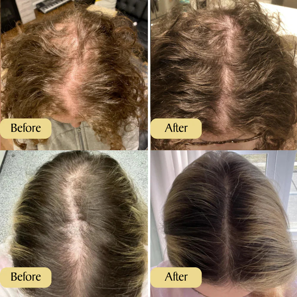 Grows Natural Hair Oil